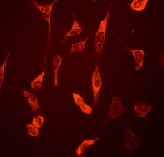 Immunocytochemistry/ Immunofluorescence - Anti-Galectin 3 antibody [EPR2774] (AB76466), expandable thumbnail