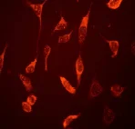 Immunocytochemistry/ Immunofluorescence - Anti-Galectin 3 antibody [EPR2774] (AB76466)