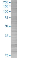 SDS-PAGE - Galectin 3 overexpression 293T lysate (whole cell) (AB94225)