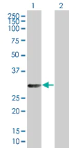 Western blot - Galectin 3 overexpression 293T lysate (whole cell) (AB94225)