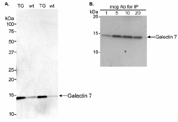 Western blot - Anti-Galectin 7 antibody (AB10482)