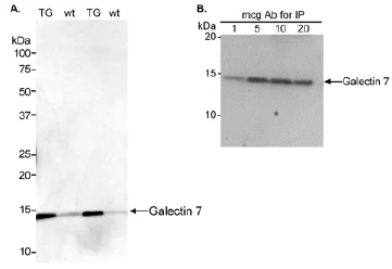 Western blot - Anti-Galectin 7 antibody (AB10482)