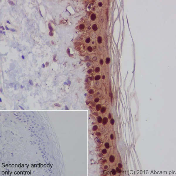 Immunohistochemistry (Formalin/PFA-fixed paraffin-embedded sections) - Anti-Galectin 7 antibody [EPR19903] (AB206435)