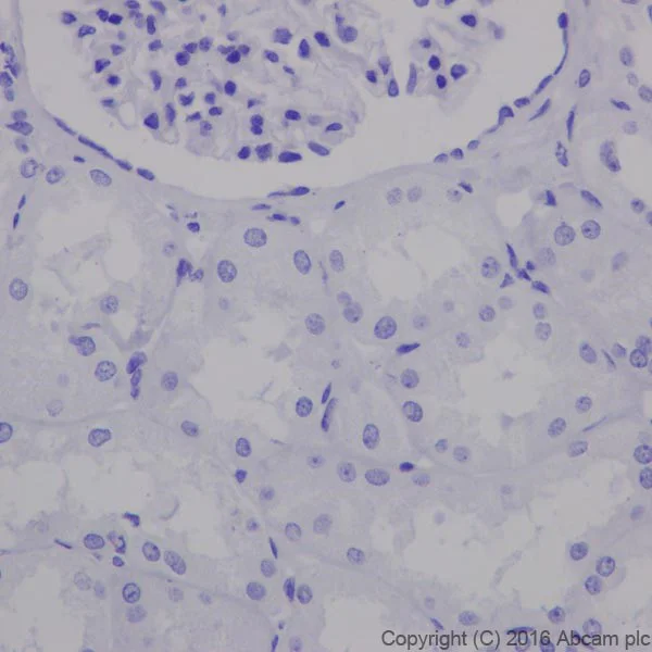 Immunohistochemistry (Formalin/PFA-fixed paraffin-embedded sections) - Anti-Galectin 7 antibody [EPR19903] (AB206435)