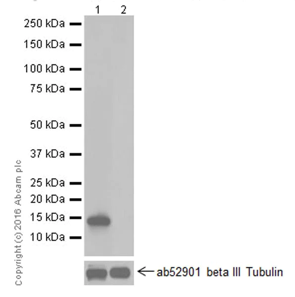 Western blot - Anti-Galectin 7 antibody [EPR19903] (AB206435)