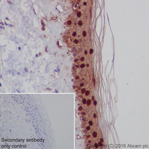 Immunohistochemistry (Formalin/PFA-fixed paraffin-embedded sections) - Anti-Galectin 7 antibody [EPR19903] - BSA and Azide free (AB240374)