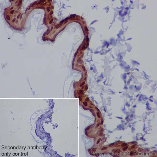 Immunohistochemistry (Formalin/PFA-fixed paraffin-embedded sections) - Anti-Galectin 7 antibody [EPR19903] - BSA and Azide free (AB240374)