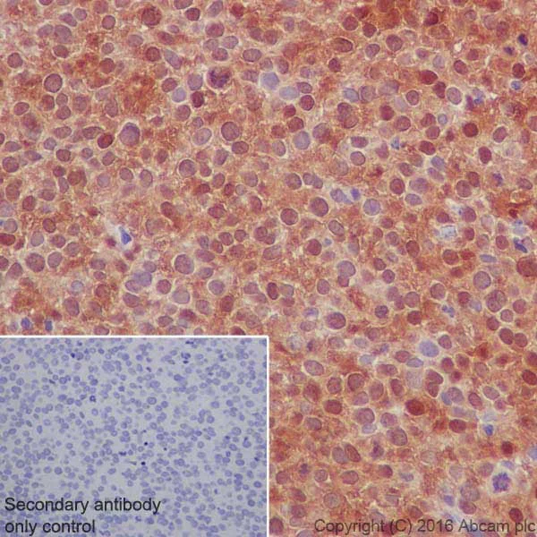 Immunohistochemistry (Formalin/PFA-fixed paraffin-embedded sections) - Anti-Galectin 7 antibody [EPR19903] - BSA and Azide free (AB240374)