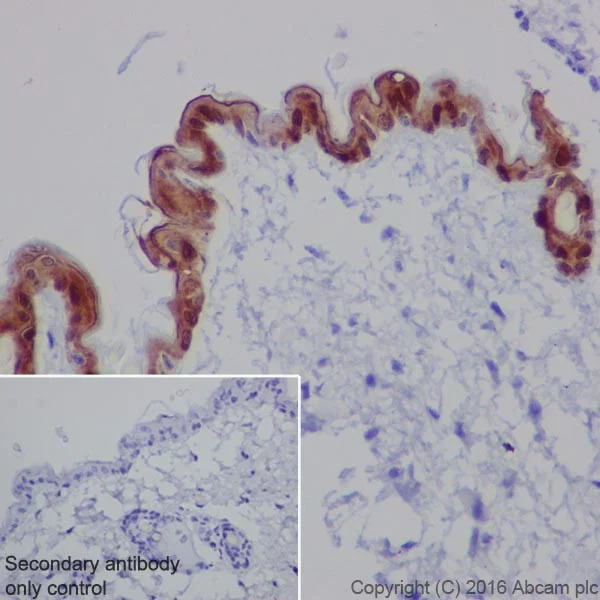 Immunohistochemistry (Formalin/PFA-fixed paraffin-embedded sections) - Anti-Galectin 7 antibody [EPR19903] - BSA and Azide free (AB240374)