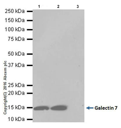 Immunoprecipitation - Anti-Galectin 7 antibody [EPR19903] - BSA and Azide free (AB240374)