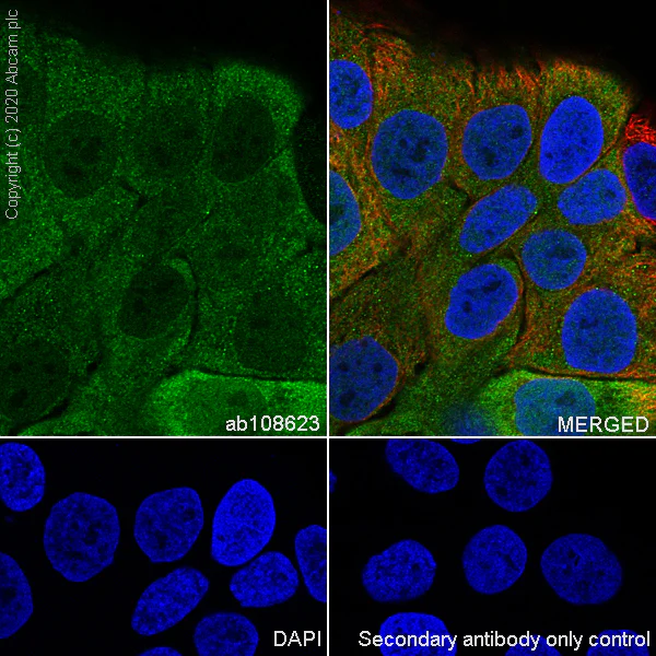 Immunocytochemistry/ Immunofluorescence - Anti-Galectin 7 antibody [EPR4287] - BSA and Azide free (AB247704)
