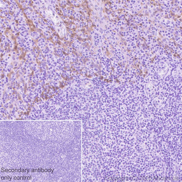 Immunohistochemistry (Formalin/PFA-fixed paraffin-embedded sections) - Anti-Galectin 7 antibody [EPR4287] - BSA and Azide free (AB247704)