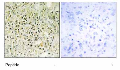 Immunohistochemistry (Formalin/PFA-fixed paraffin-embedded sections) - Anti-Galectin 8/Gal-8 antibody (AB69631)
