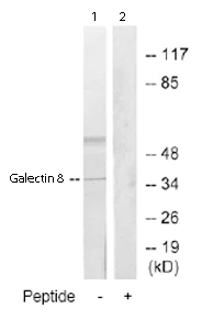 Western blot - Anti-Galectin 8/Gal-8 antibody (AB69631)