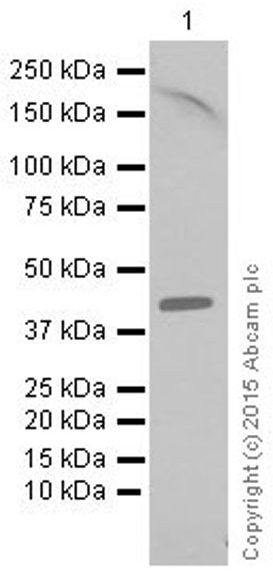 Western blot - Anti-Galectin 8/Gal-8 antibody [EPR4857] (AB109519), expandable thumbnail