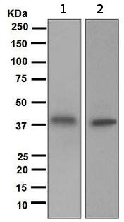 Western blot - Anti-Galectin 8/Gal-8 antibody [EPR4857] (AB109519), expandable thumbnail