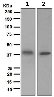 Western blot - Anti-Galectin 8/Gal-8 antibody [EPR4857] (AB109519)