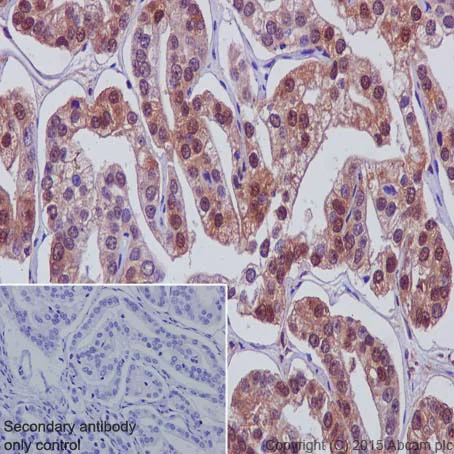 Immunohistochemistry (Formalin/PFA-fixed paraffin-embedded sections) - Anti-Galectin 8/Gal-8 antibody [EPR4857] - BSA and Azide free (AB239983)