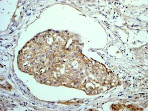 Immunohistochemistry (Formalin/PFA-fixed paraffin-embedded sections) - Anti-Galectin 8/Gal-8 antibody [EPR4857] - BSA and Azide free (AB239983)