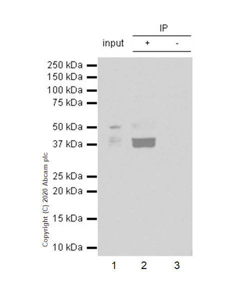 Immunoprecipitation - Anti-Galectin 8/Gal-8 antibody [EPR4857] - BSA and Azide free (AB239983), expandable thumbnail
