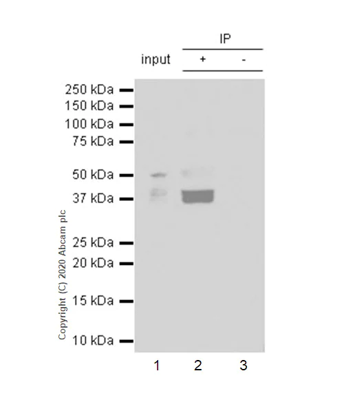 Immunoprecipitation - Anti-Galectin 8/Gal-8 antibody [EPR4857] - BSA and Azide free (AB239983)