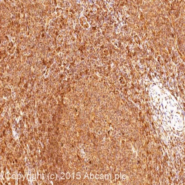 Immunohistochemistry (Formalin/PFA-fixed paraffin-embedded sections) - Anti-galectin 9/Gal-9 antibody [1G3] (AB153673)
