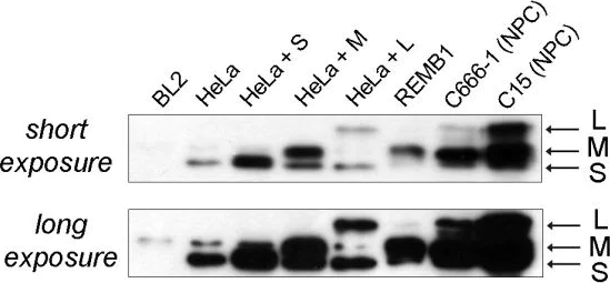 Western blot - Anti-galectin 9/Gal-9 antibody [1G3] (AB153673)