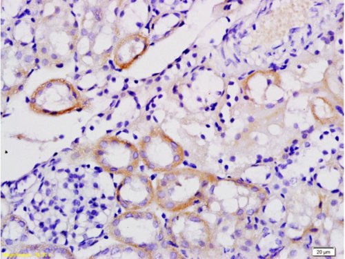 Immunohistochemistry (Formalin/PFA-fixed paraffin-embedded sections) - Anti-galectin 9/Gal-9 antibody (AB216479), expandable thumbnail