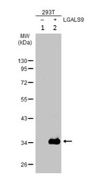 Western blot - Anti-galectin 9/Gal-9 antibody (AB228686)