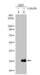 Western blot - Anti-galectin 9/Gal-9 antibody (AB228686)