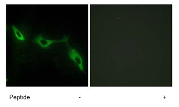 Immunocytochemistry/ Immunofluorescence - Anti-galectin 9/Gal-9 antibody (AB69630), expandable thumbnail
