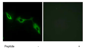 Immunocytochemistry/ Immunofluorescence - Anti-galectin 9/Gal-9 antibody (AB69630)