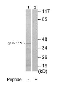 Western blot - Anti-galectin 9/Gal-9 antibody (AB69630), expandable thumbnail