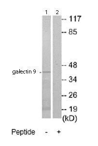 Western blot - Anti-galectin 9/Gal-9 antibody (AB69630)