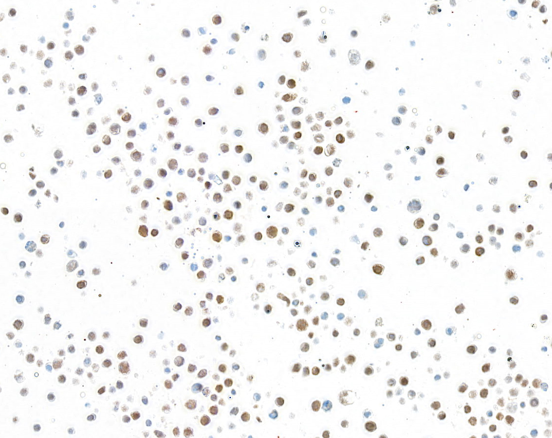 Immunocytochemistry - Anti-Galectin-9/Gal-9 antibody [BLR193J] - BSA free (ab314081), expandable thumbnail