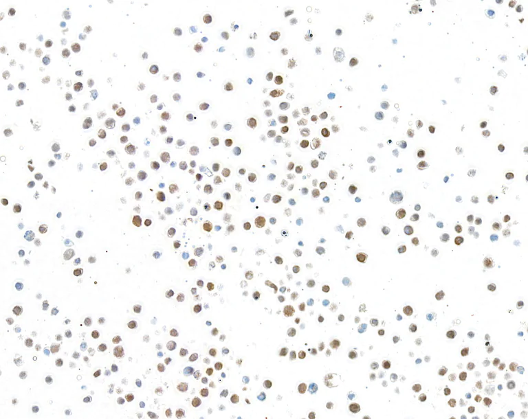 Immunocytochemistry - Anti-Galectin-9/Gal-9 antibody [BLR193J] - BSA free (AB314081)