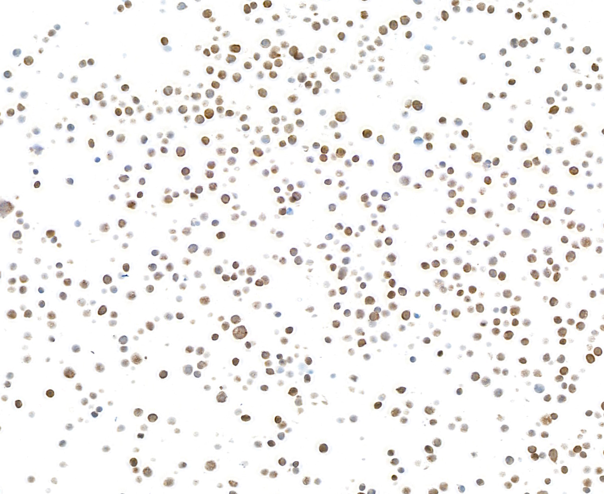 Immunocytochemistry - Anti-Galectin-9/Gal-9 antibody [BLR193J] - BSA free (ab314081), expandable thumbnail