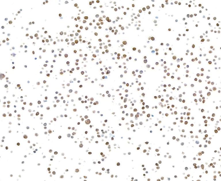 Immunocytochemistry - Anti-Galectin-9/Gal-9 antibody [BLR193J] - BSA free (AB314081)