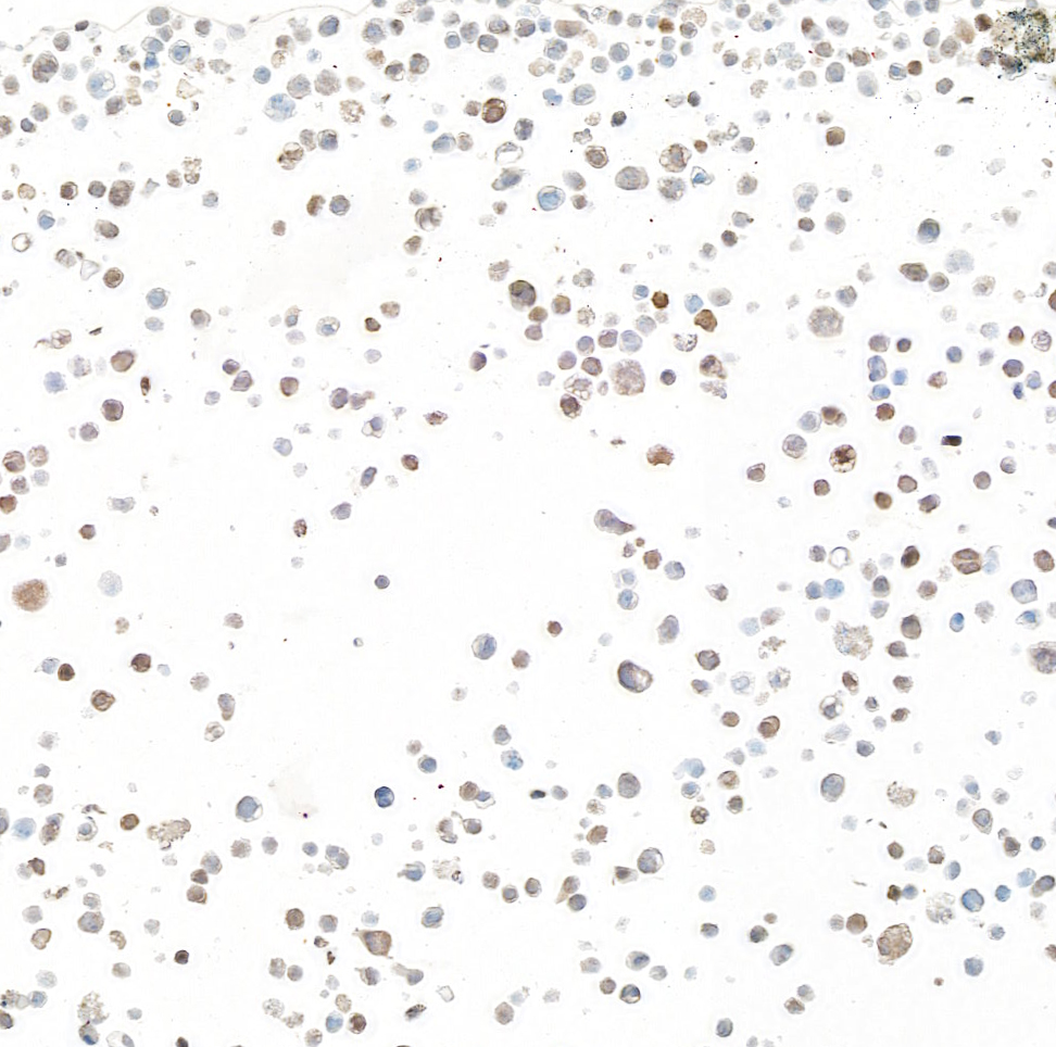 Immunocytochemistry - Anti-Galectin-9/Gal-9 antibody [BLR193J] - BSA free (ab314081), expandable thumbnail