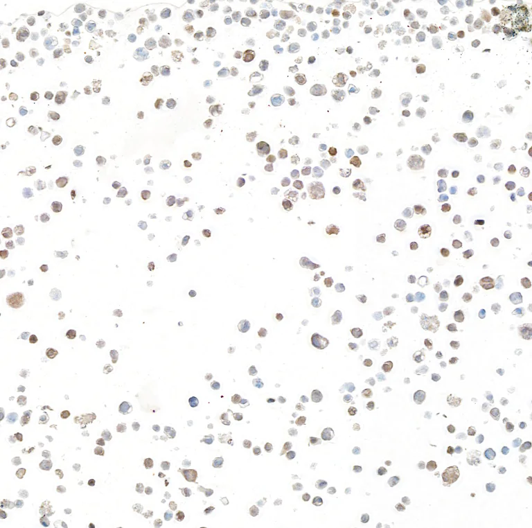 Immunocytochemistry - Anti-Galectin-9/Gal-9 antibody [BLR193J] - BSA free (AB314081)