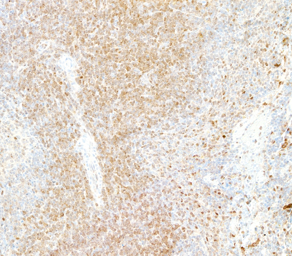 Immunohistochemistry (Formalin/PFA-fixed paraffin-embedded sections) - Anti-Galectin-9/Gal-9 antibody [BLR193J] - BSA free (AB314081), expandable thumbnail