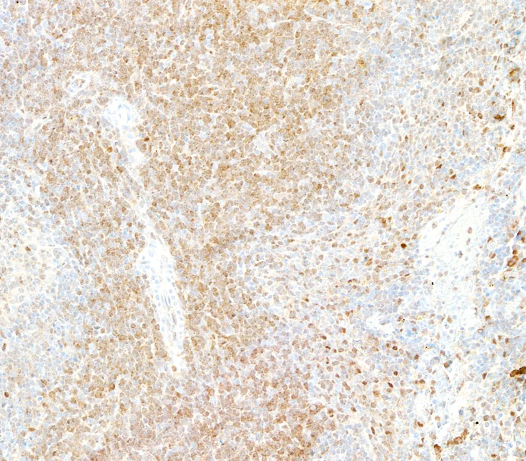 Immunohistochemistry (Formalin/PFA-fixed paraffin-embedded sections) - Anti-Galectin-9/Gal-9 antibody [BLR193J] - BSA free (AB314081)