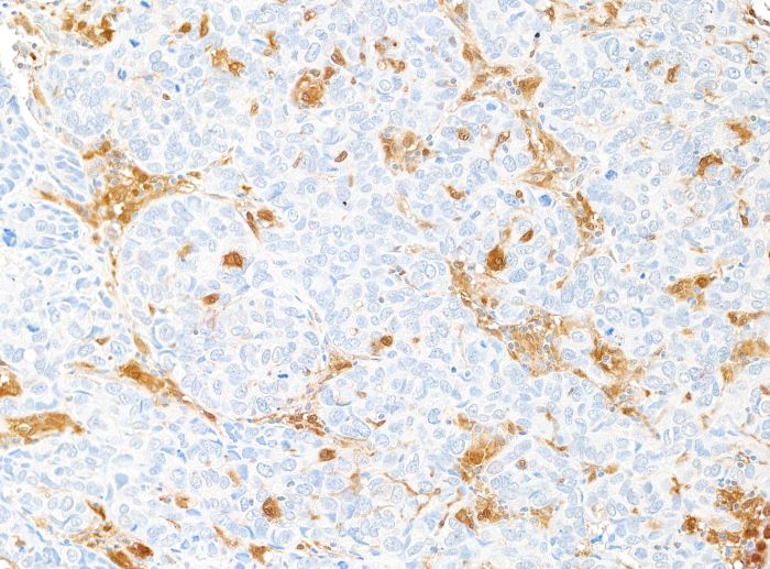 Immunohistochemistry (Formalin/PFA-fixed paraffin-embedded sections) - Anti-Galectin-9/Gal-9 antibody [BLR193J] - BSA free (AB314081), expandable thumbnail
