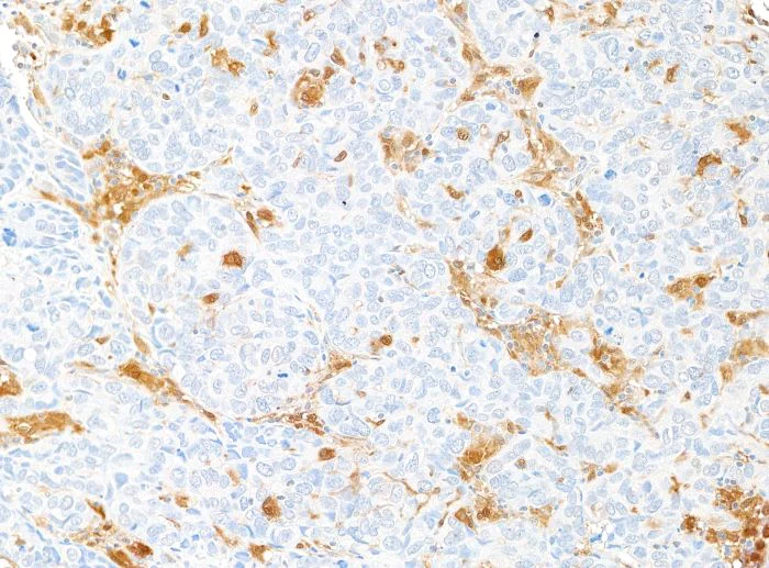 Immunohistochemistry (Formalin/PFA-fixed paraffin-embedded sections) - Anti-Galectin-9/Gal-9 antibody [BLR193J] - BSA free (AB314081)