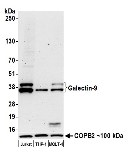 Western blot - Anti-Galectin-9/Gal-9 antibody [BLR193J] - BSA free (ab314081), expandable thumbnail