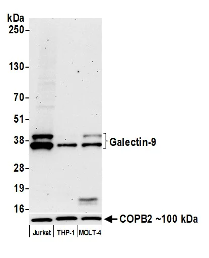 Western blot - Anti-Galectin-9/Gal-9 antibody [BLR193J] - BSA free (AB314081)