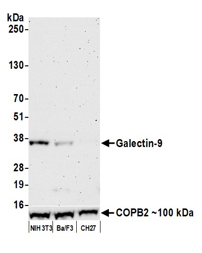Western blot - Anti-Galectin-9/Gal-9 antibody [BLR193J] - BSA free (AB314081), expandable thumbnail