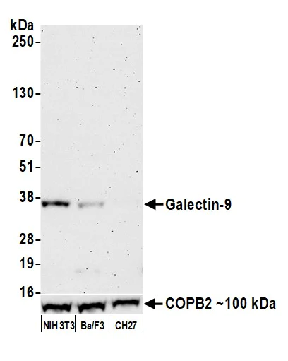 Western blot - Anti-Galectin-9/Gal-9 antibody [BLR193J] - BSA free (AB314081)