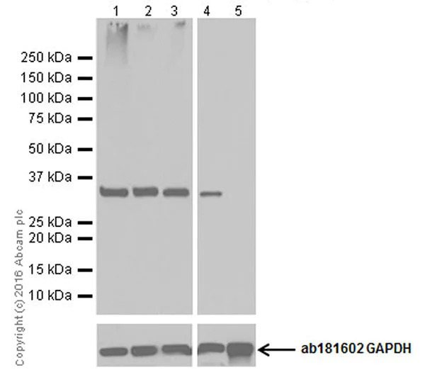 Western blot - Anti-galectin 9/Gal-9 antibody [EPR19182] - BSA and Azide free (AB250745)