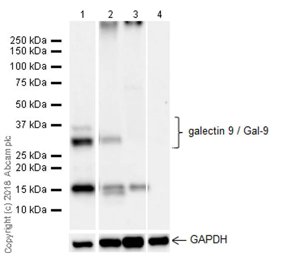 Western blot - Anti-galectin 9/Gal-9 antibody [EPR22214] (AB227046)